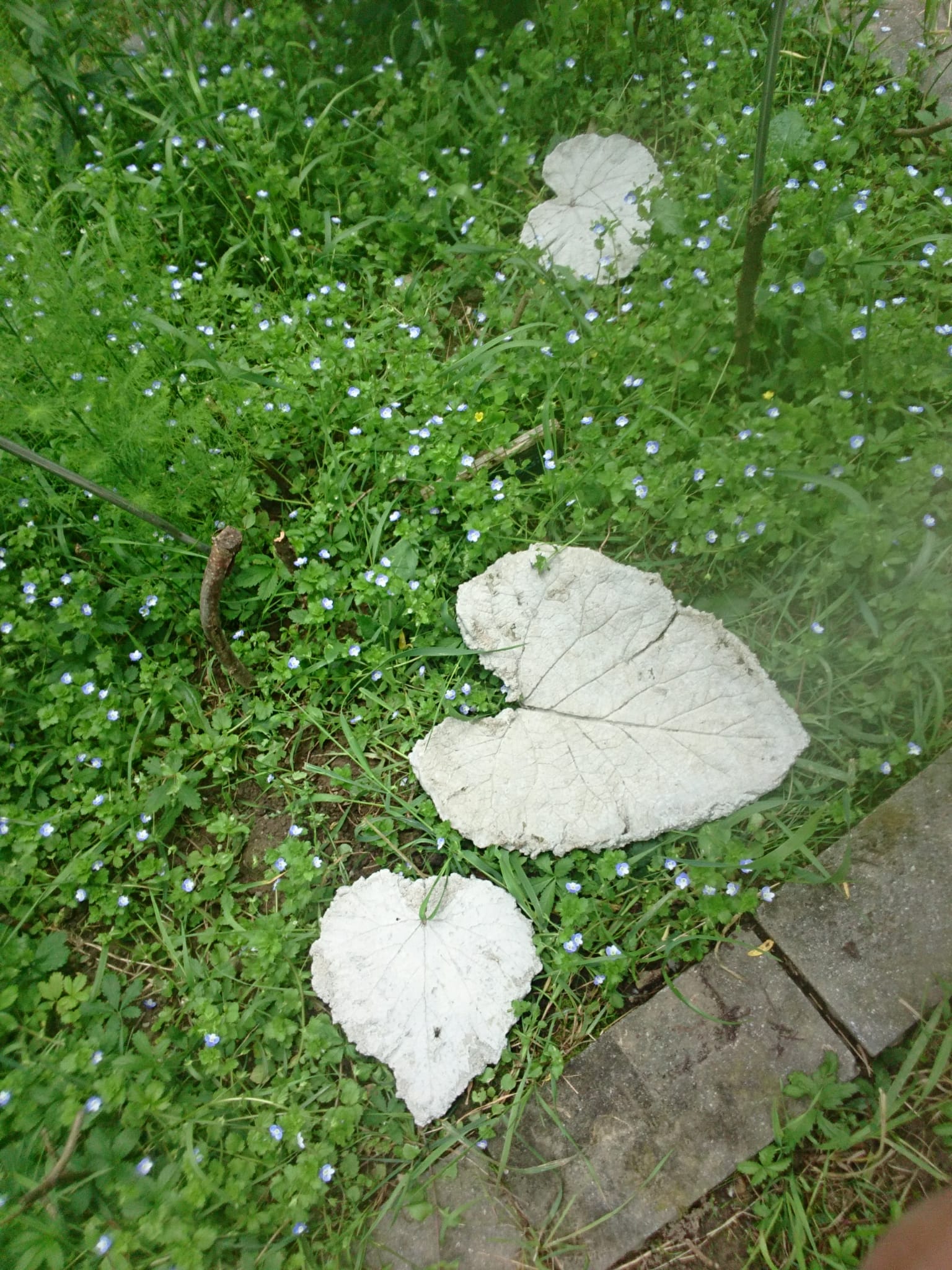 Témoignage suite à une grossesse extra utérine